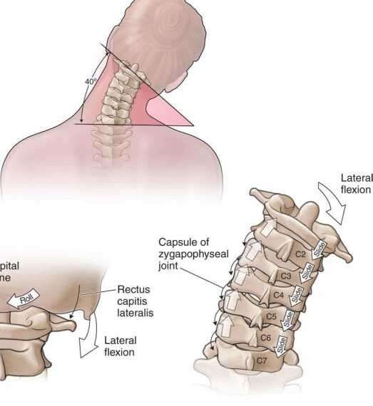 2 упражнения, которые заставят вас забыть о боли в области шеи