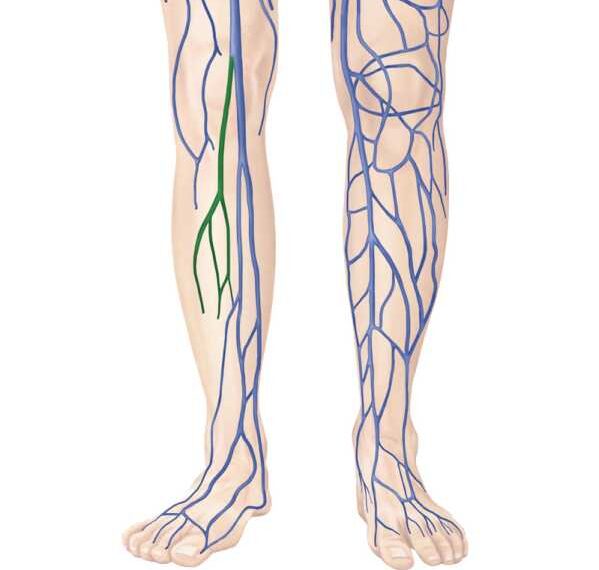 ЕСЛИ БОЛИТ СЕРДЦЕ — ЛЕЧИТЕ НОГИ