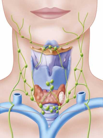 Тиреоидит Хашимото: Причины и последствия