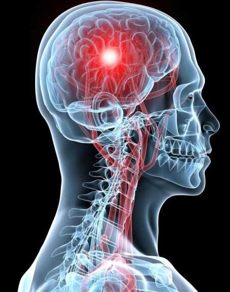 Что такое исполнительная дисфункция