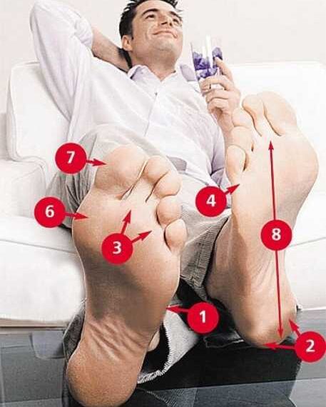 О каких болезнях сигналят мозоли