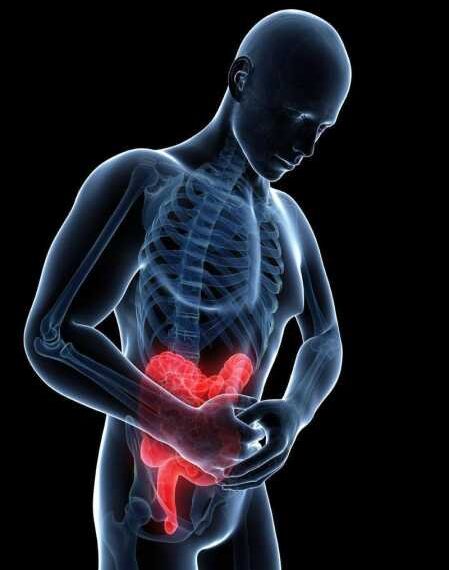 Болезнь Крона: Симптомы заболевания