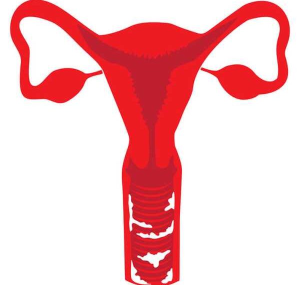 МОЛОЧНИЦА: ОПАСНЕЕ, чем вы думали