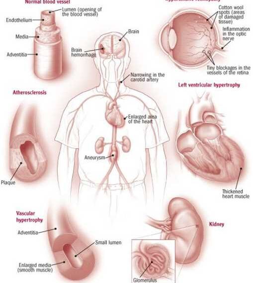 ПОВЫШЕННОЕ ДАВЛЕНИЕ: как держать гипертонию под контролем