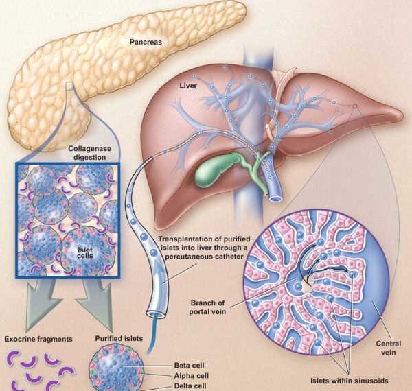 Заболевания печени, желчного пузыря и поджелудочной железы: Лечение