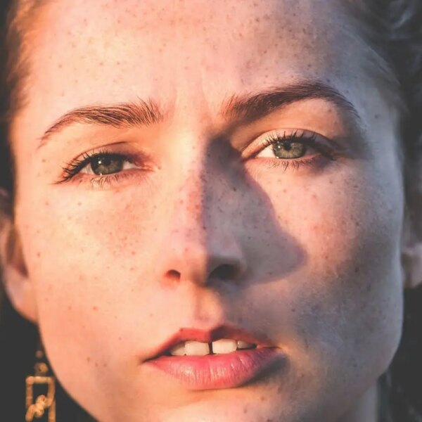 Весняний авітаміноз: чому лущаться щоки і як допомогти без дорогих кремів