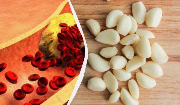 Як часник впливає на рівень холестерину: 5 ефектів